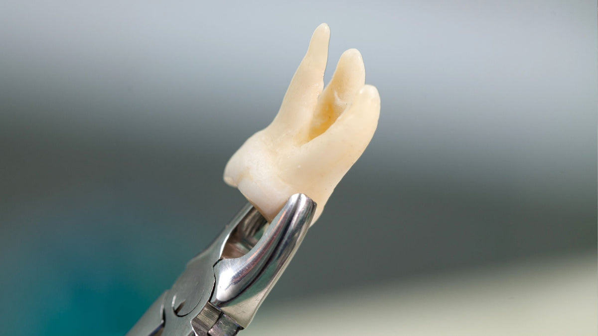 Dog Tooth Extraction in Singapore: Cost, Procedure and Recovery (2026 Guide)